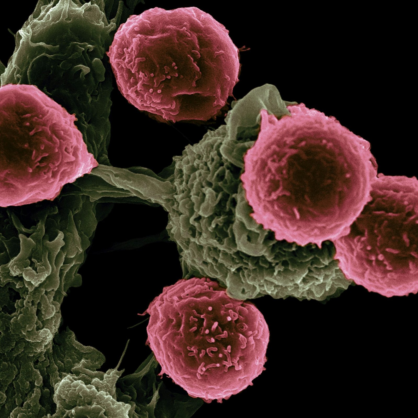 Clasificación general del cáncer